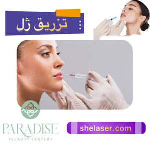 تزریق ژل