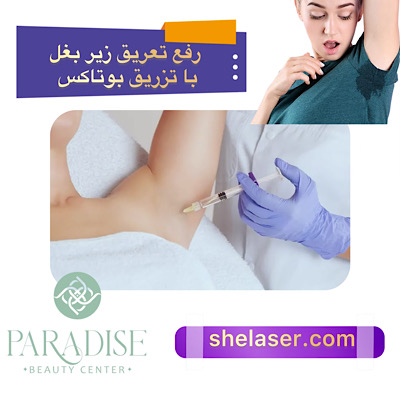 رفع تعریق زیر بغل با تزریق بوتاکس