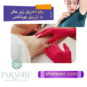 رفع تعریق زیر بغل با تزریق بوتاکس