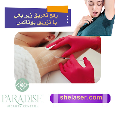 رفع تعریق زیر بغل با تزریق بوتاکس