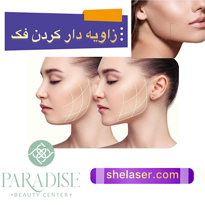 زاویه دار کردن فک