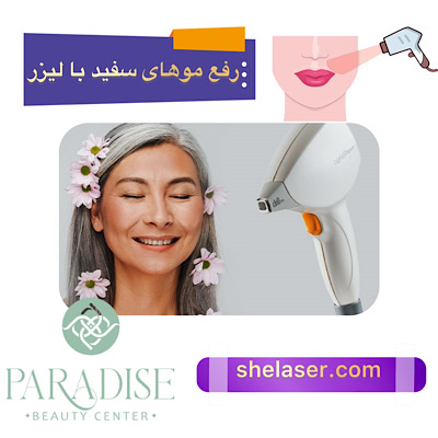 رفع موهای سفید با لیزر در تهران