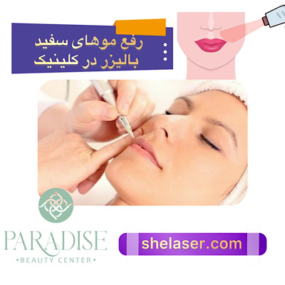 رفع موهای سفید با لیزر در کلینیک