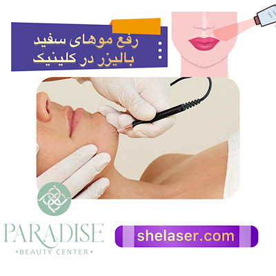 رفع موهای سفید با لیزر در کلینیک