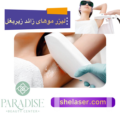 لیزر موهای زائد زیر بغل