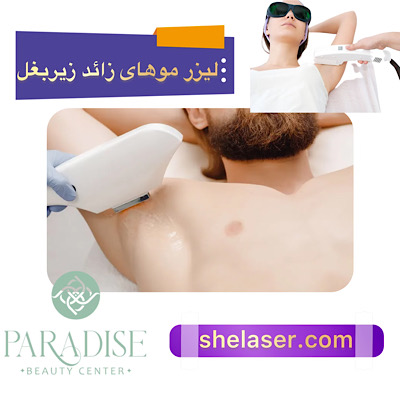 لیزر موهای زائد زیربغل
