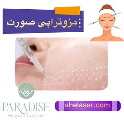 مزوتراپی صورت