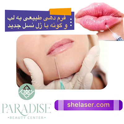 فرم‌دهی طبیعی به لب و گونه با ژل‌های نسل جدید