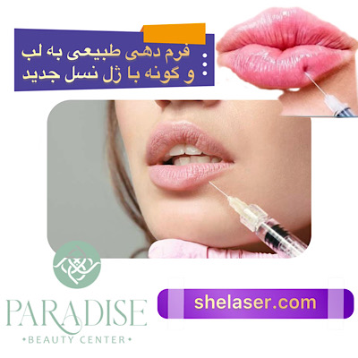 فرم‌دهی طبیعی به لب و گونه با ژل‌های نسل جدید