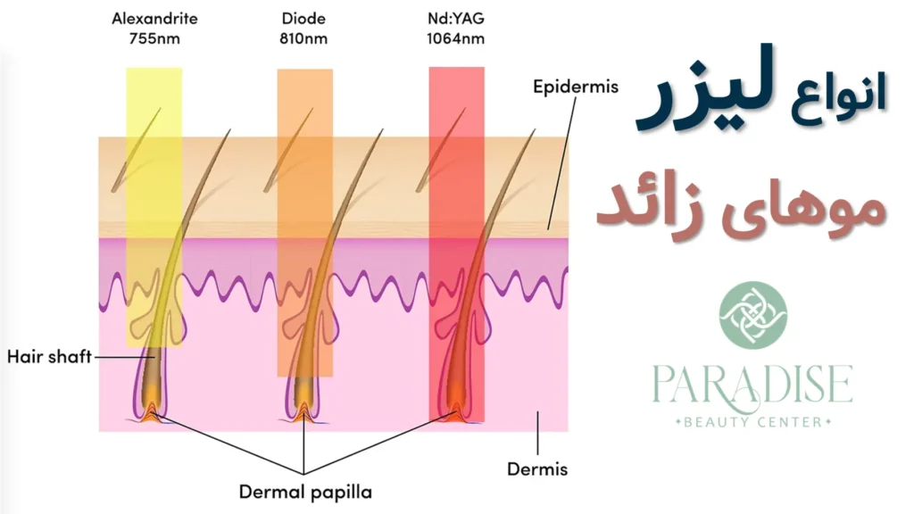 به دلایل رایج رشد دوباره مو بعد از لیزر