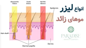 به دلایل رایج رشد دوباره مو بعد از لیزر