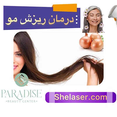  درمان ریزش مو
