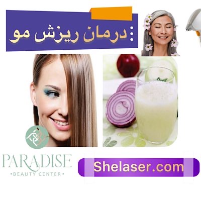  درمان ریزش مو