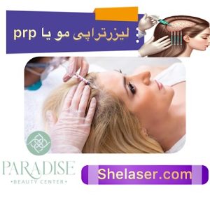 لیزر تراپی مو یا PRP