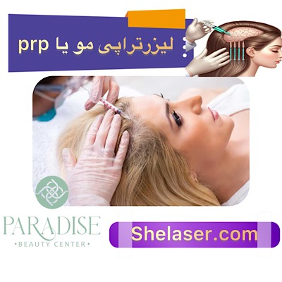 لیزر تراپی مو یا PRP