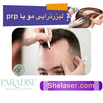 لیزر تراپی مو یا PRP