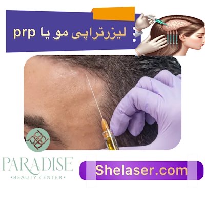 لیزر تراپی مو یا PRP