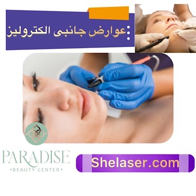عوارض جانبی الکترولیز