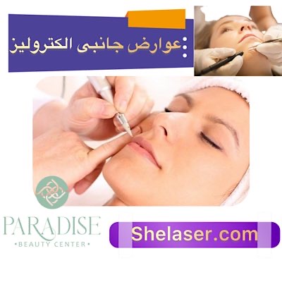 عوارض جانبی الکترولیز
