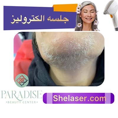 جلسه الکترولیز