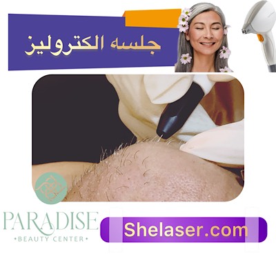 جلسه الکترولیز