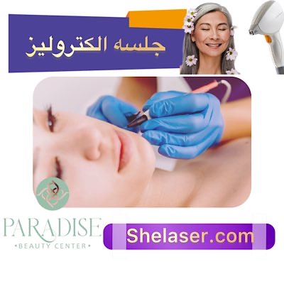 جلسه الکترولیز