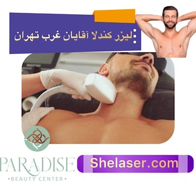 لیزر کندلا آقایان غرب تهران