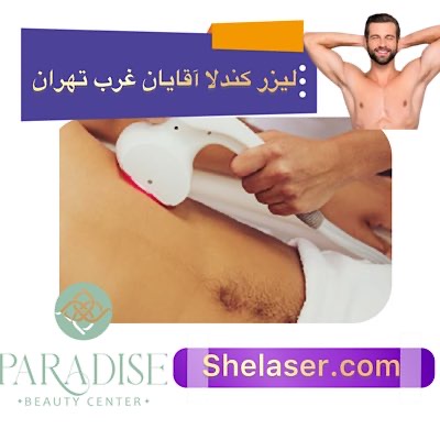 لیزر کندلا آقایان غرب تهران