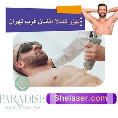 لیزر کندلا آقایان غرب تهران
