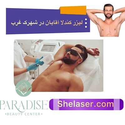 لیزر کندلا آقایان در شهرک غرب