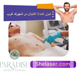 لیزر کندلا آقایان در شهرک غرب