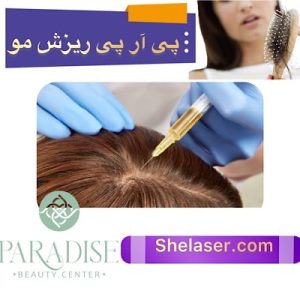 پی آر پی ریزش مو