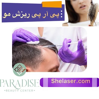 پی آر پی ریزش مو