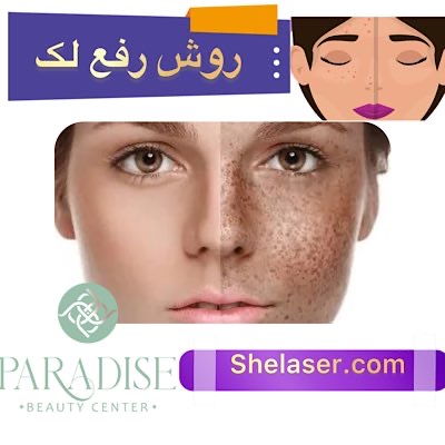 روش رفع لک