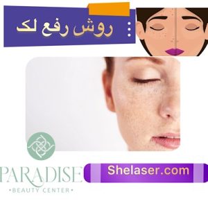 روش رفع لک