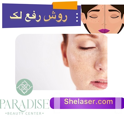 روش رفع لک