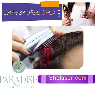 درمان ریزش مو با لیزر