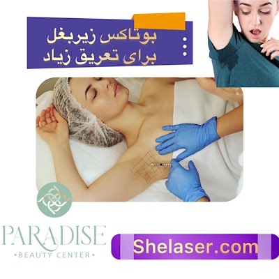 بوتاکس زیر بغل برای تعریق زیاد