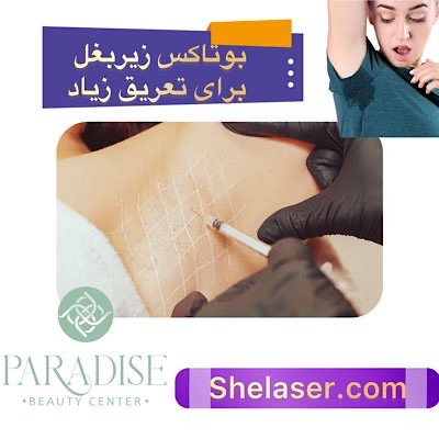 بوتاکس زیر بغل برای تعریق زیاد