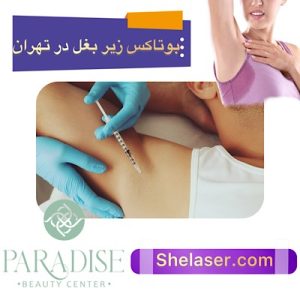 بوتاکس زیر بغل در تهران