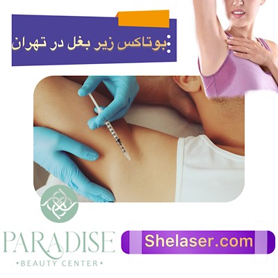 بوتاکس زیر بغل در تهران