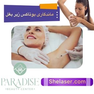 ماندگاری بوتاکس زیر بغل