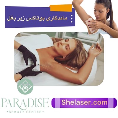 ماندگاری بوتاکس زیر بغل