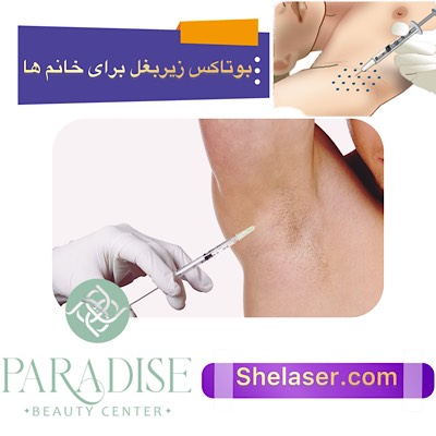 بوتاکس زیر بغل برای خانم‌ها