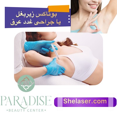 بوتاکس زیر بغل و جراحی غدد عرق