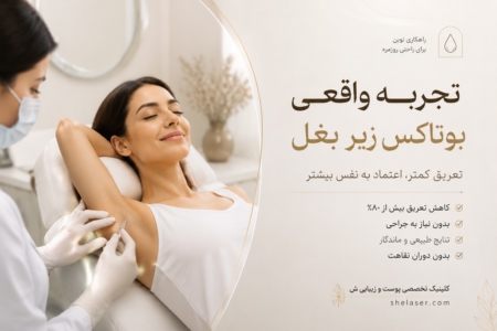 بوتاکس زیر بغل تجربه واقعی