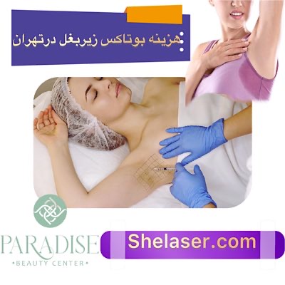 هزینه بوتاکس زیر بغل در تهران