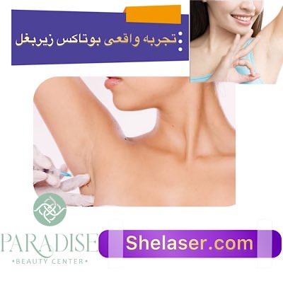 تجربه واقعی بوتاکس زیر بغل