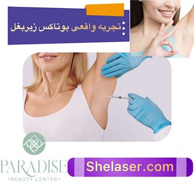 تجربه واقعی بوتاکس زیر بغل