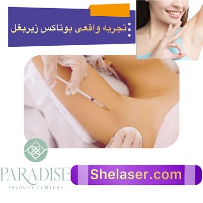 تجربه واقعی بوتاکس زیر بغل